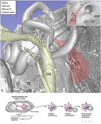 Human Inner Ear Immune Activity: A Super-Resolution Immunohistochemistry Study